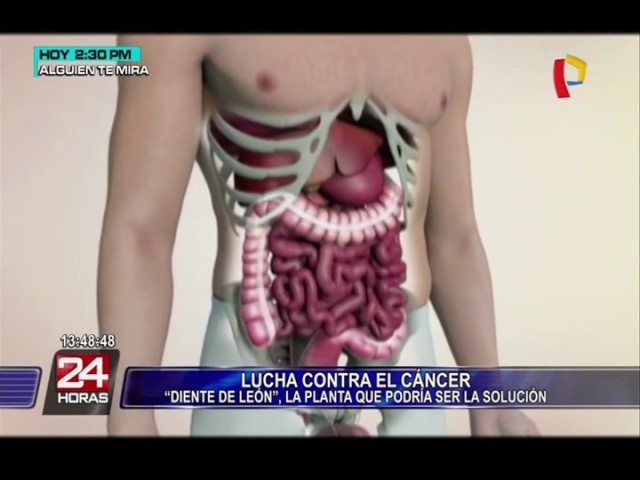 beneficios del diente de leon para el cancer