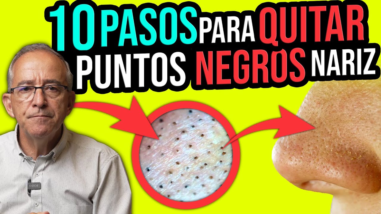 como eliminar los puntos negros de la nariz