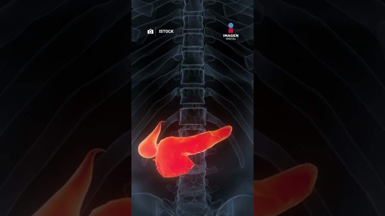 la mujer de heinz esta enferma de cancer