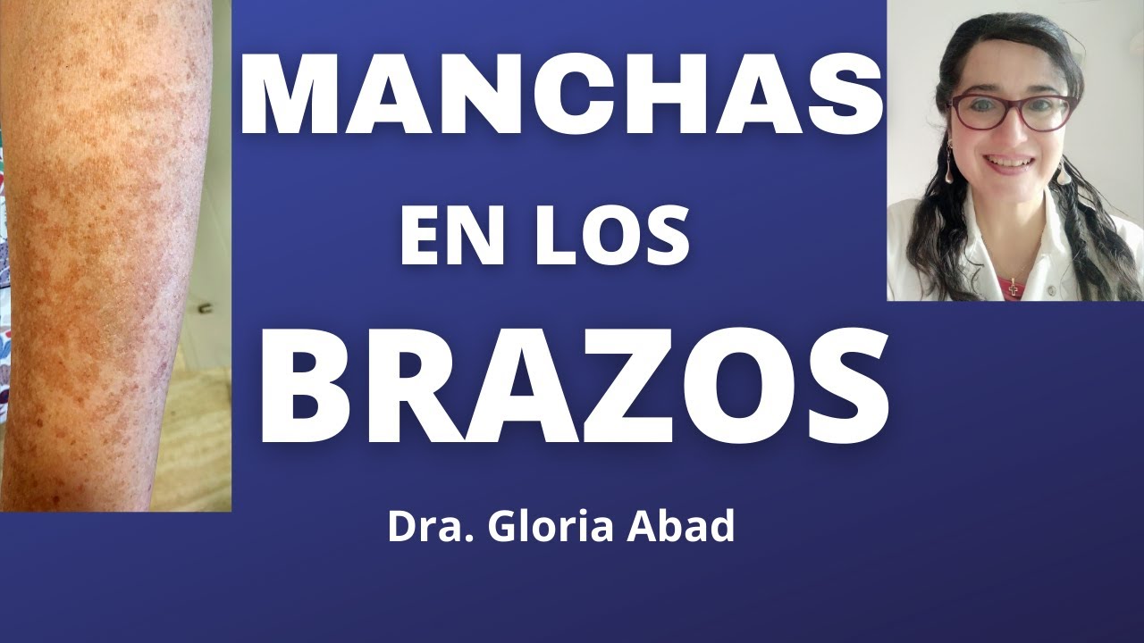 como quitar las manchas del sol de los brazos