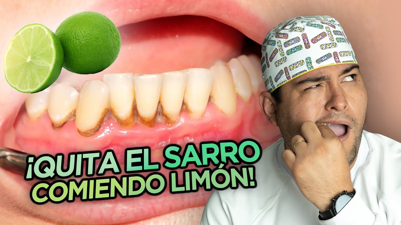 que es bueno para quitar el sarro de los dientes