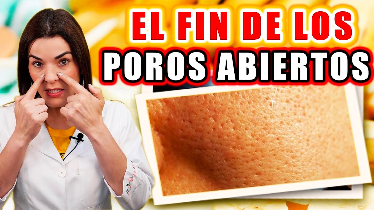remedios caseros para serrar los poros de la cara