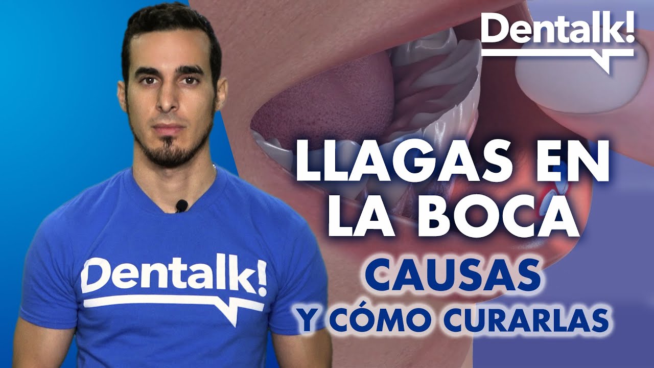 como curar una herida en la boca por dentro