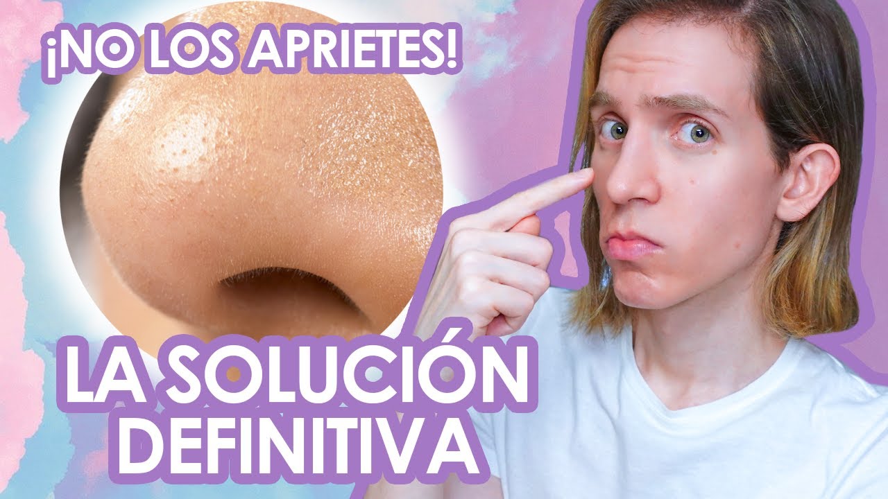 como quitar los puntos de la nariz rapido