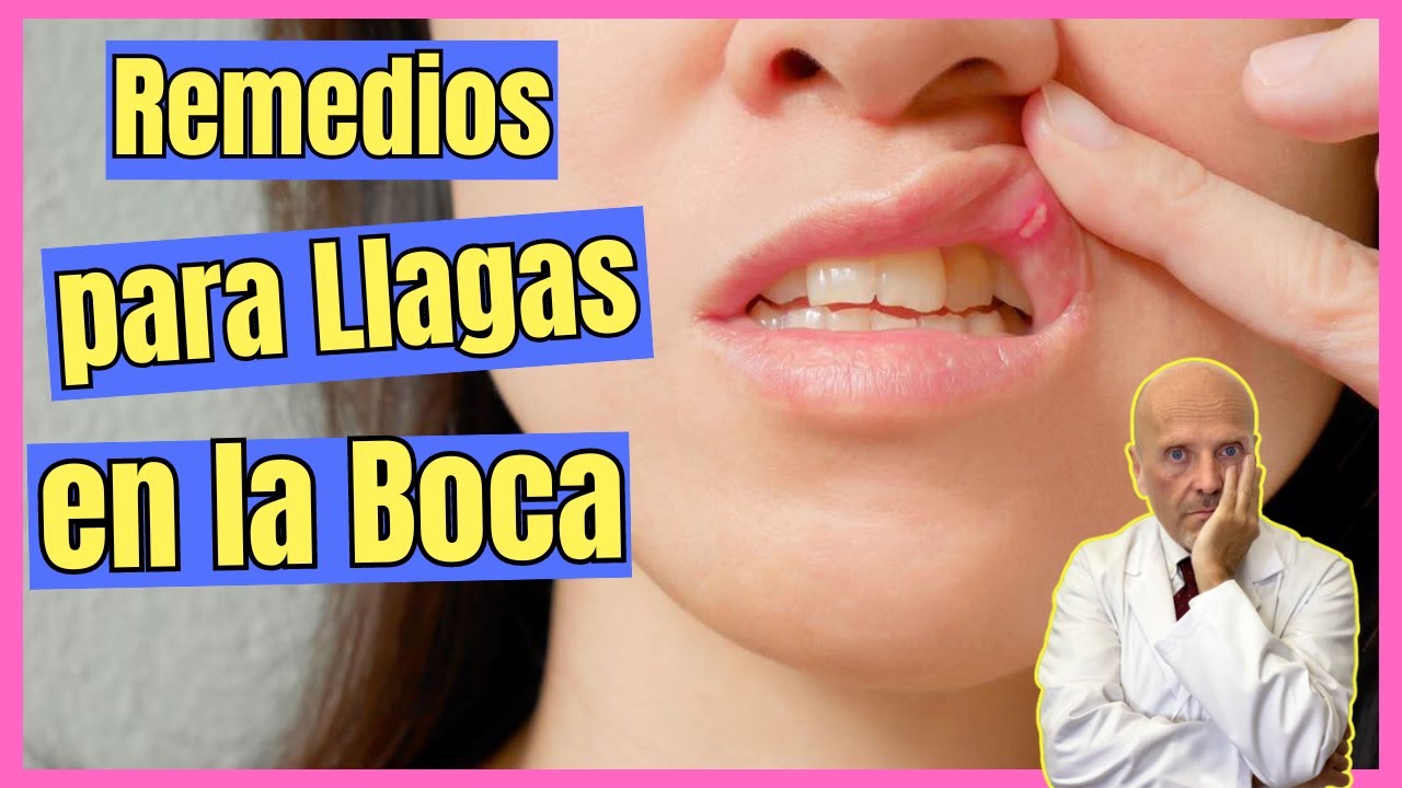 como eliminar una llaga de la boca rapido