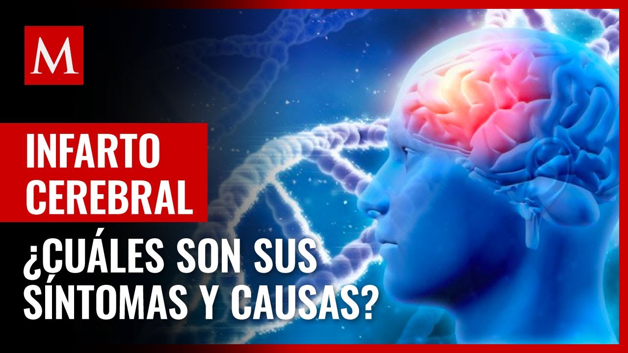 cuál es la causa de un derrame cerebral